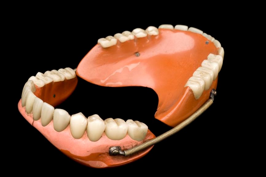 Permanent Dentures Procedure San Jose CA 95123